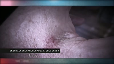 The next day,
I noticed weird red marks - Beyond Skinwalker Ranch