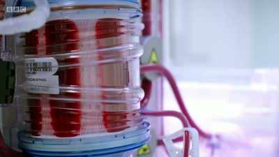 The organ's being kept alive by the
perfusion machine, - Surgeons: At the Edge of Life