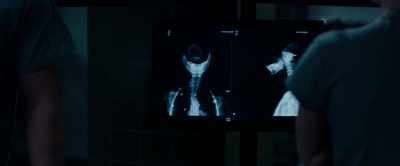 The partial decapitation
was made by a circular saw. - Jigsaw