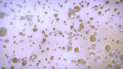 The plants that live inside them
photosynthesize, - Chasing Coral