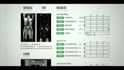 The protocols, the measurements,
the recipes, the supplements, - Don't Die: The Man Who Wants to Live Forever