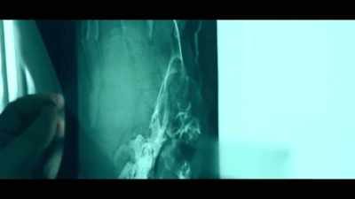 The radiographs immediately
showed that there was - The Real Prime Suspect