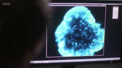 The really unexpected thing
was to see that there's a complex - The Human Body: Secrets of Your Life Revealed