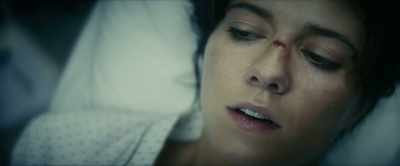 The reason I ask is you appear to be
suffering from accelerated ARS. - Kate