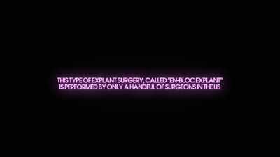 The reason why there is
so few plastic surgeons - Explant