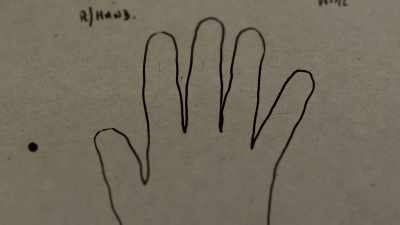 The scratches were visible, - Sophie: A Murder in West Cork