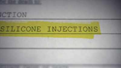 The silicone injections
create embolisms - Impact x Nightline