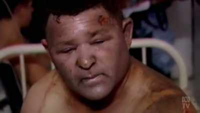 "The swelling
will take over his airway - Aussie Inventions That Changed The World