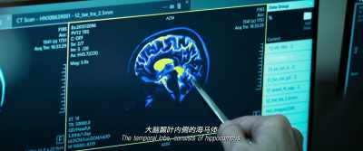 The temporal lobe consists of hippocampus - Shock Wave 2