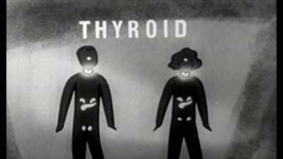 The thyroid hormone that
comes from the thyroid, - Toxic Beauty