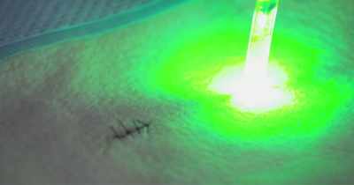 The waveguide is a light delivery device, - White Rabbit Project