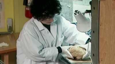 - The width of the brain,
from left to right, - The Man Who Stole Einstein's Brain