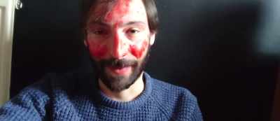 Then a few days later,
Brad starts getting - 5G Zombies
