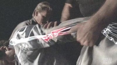 Then the elbow,
like knuckles popping- - Bones