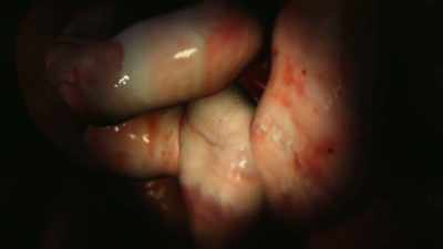 There, it begins reproducing and creating offspring parasites. - Zombies! Prepping for the Apocalypse