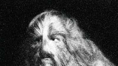 THERE IS A GENETIC CONDITION
KNOWN AS HYPERTRICHOSIS - Strange Evidence