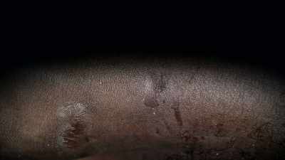 There were ligature
marks around his ankles, - First Blood