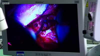 There is not a large number of us
that do this, - Surgeons: At the Edge of Life