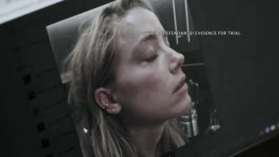 There were photographs
of her injuries. - Johnny vs Amber