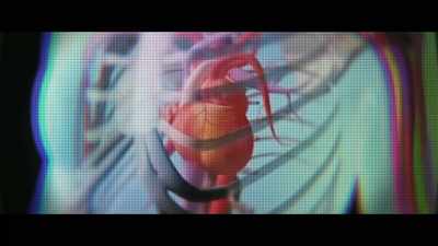 There's a small procedure
that you can do called an ablation. - Untold: Breaking Point