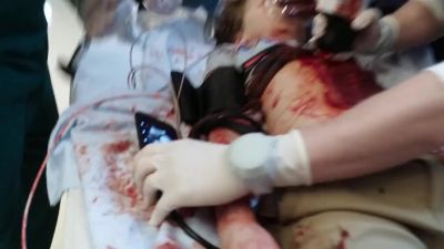There's blood entering - The Resident