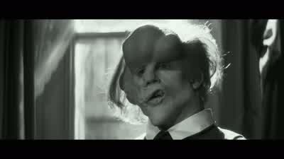 There's something that I've been meaning to ask youfor some time now What's thatCan you cure meNo we erWe can care for you but weWe can't cure youI thought not - The Elephant Man