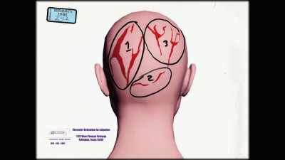 THESE ARE WOUNDS
THAT THIS DOCTOR - An American Murder Mystery: The Staircase
