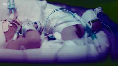 These babies born prematurely - The Human Body: Secrets of Your Life Revealed
