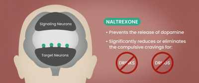 These implants block the
opiate receptors in the brain, - Body Brokers