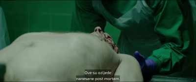 These injuries
were post-mortem. - The Collini Case