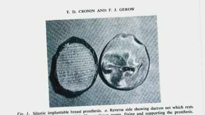 These were making people sick
and ill, - Explant