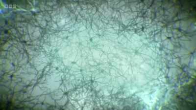 These synapses turn a collection
of 80 billion brain cells - The Human Body: Secrets of Your Life Revealed