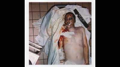 They fracture his skull,
was actually what they do. - Betrayal at Attica