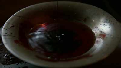 They pioneered bloodletting, - Origins: The Journey of Humankind