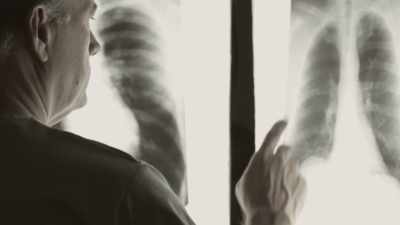 They said, "There's nothing
wrong with the ribs." - Toxic Beauty