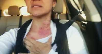 They're starting to merge
together and get really huge - Heal
