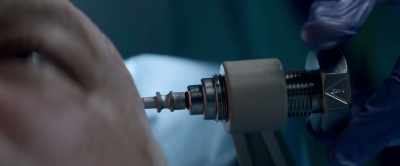 This is an
experimental procedure. - Sleeping Dogs