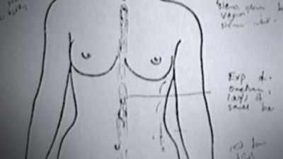 - This body was
not only strangled, - First Blood