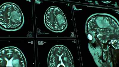 This created front lobe damage
in his brain. - The Freeway Killer: Lost Murder Tapes