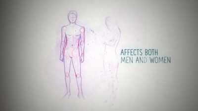 This distressing condition
affects both men and women, - Naked Education