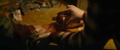 This doesn't look like
you got cut by glass. - Wolf Man