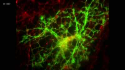 This extraordinary footage - The Human Body: Secrets of Your Life Revealed