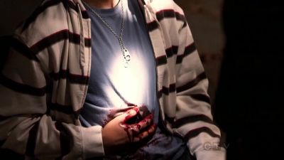 This guy's gone.
Looks like he bled out - Blue Bloods