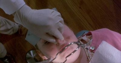 This is how we bond our teeth - The Dentist 2