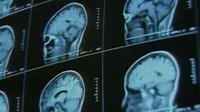 This illness is breaking out - Thank You Dr. Fauci