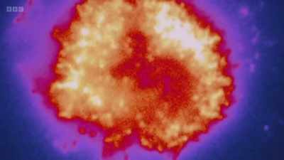 This image was unimaginable
a few years ago. - The Human Body: Secrets of Your Life Revealed