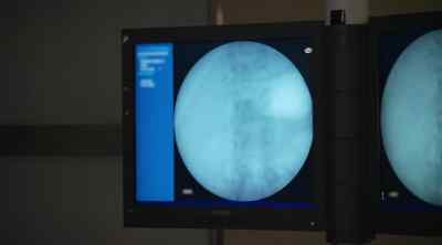 THIS IS A DELICATE OPERATION, - My 600-lb Life