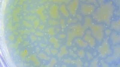 This microbiome is a living,
breathing organism… - Human: The World Within