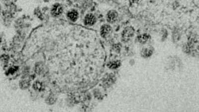 This proposal wanted to create a virus - Thank You Dr. Fauci