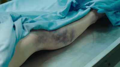 This side of her body is badly bruised, - The Brokenwood Mysteries